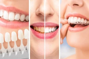 Cosmetic Dentistry